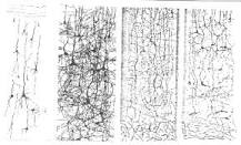 What is neural pruning?